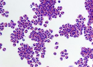 10 Interesting Facts about White Blood Cells